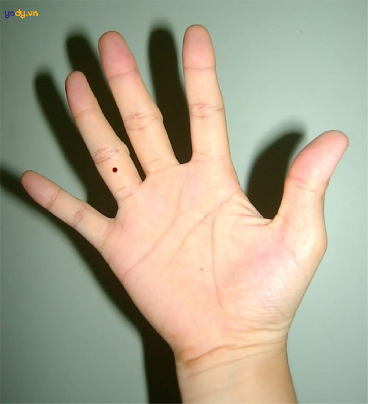 Khám phá: Ý nghĩa nốt ruồi ở ngón tay nam nữ là tốt hay xấu?, , Tin Tức